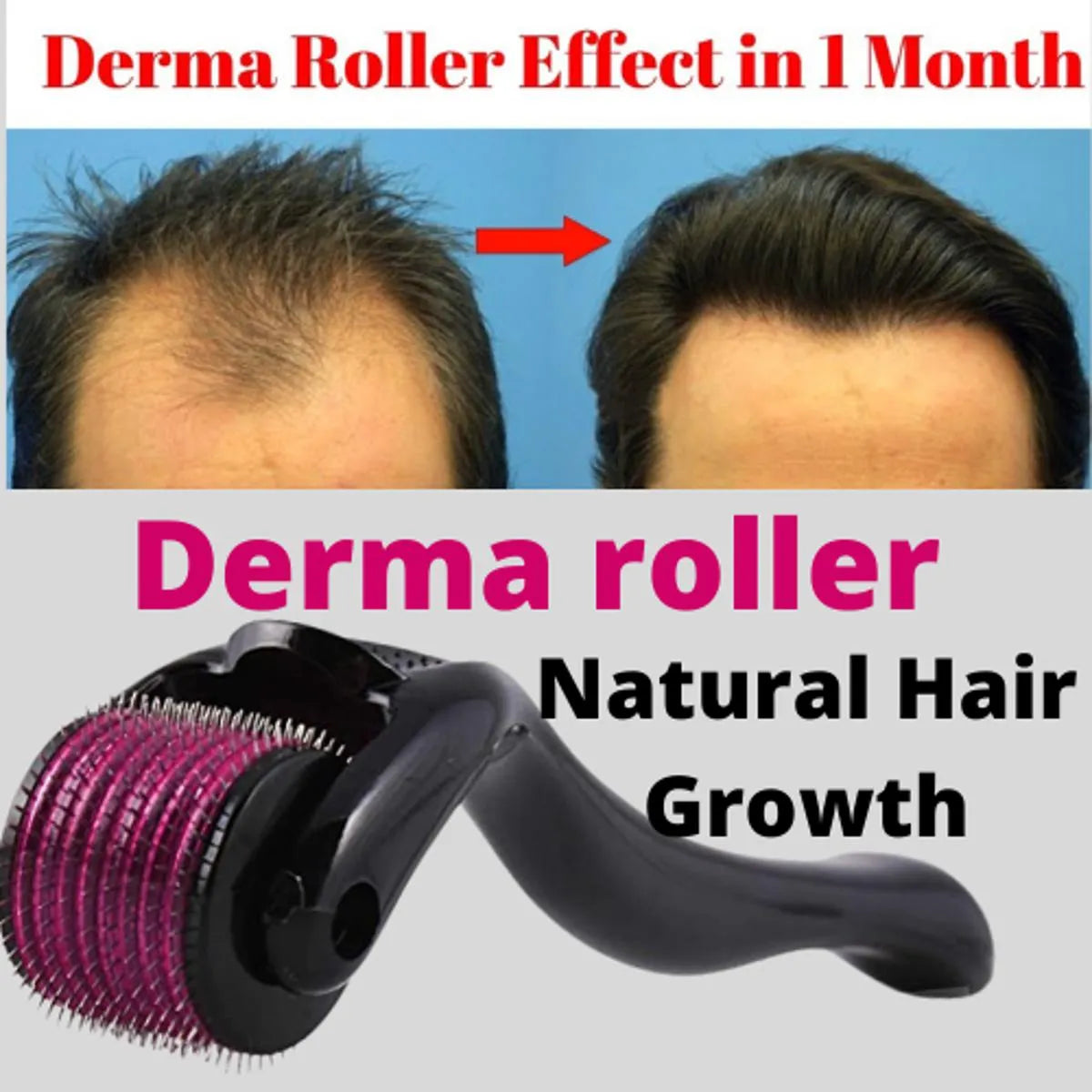Advertisement for derma roller with before and after hair growth comparison and product image.